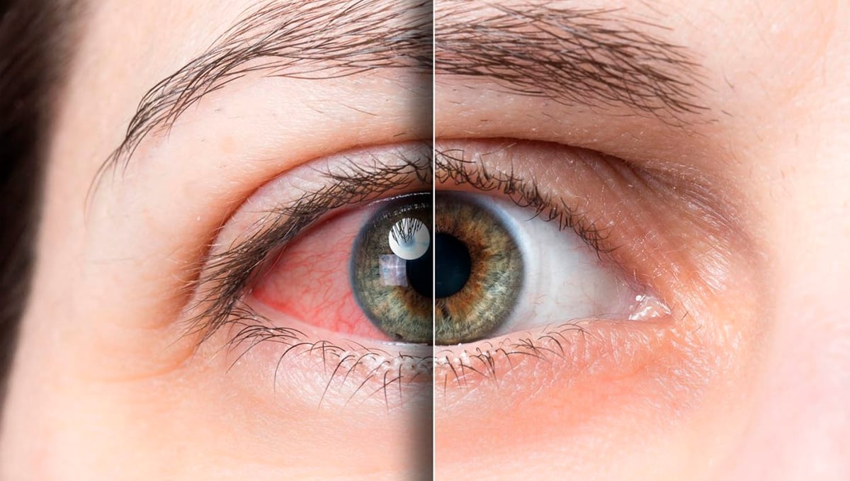 The vasodilation effect of cannabis The vasodilation effect of cannabis