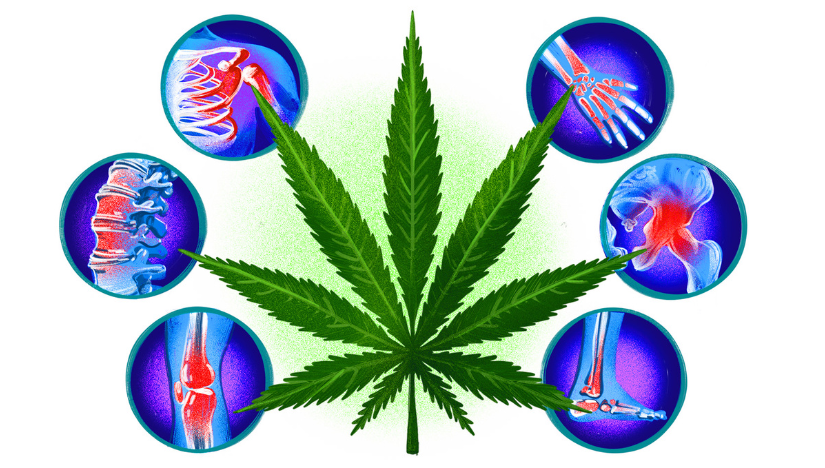 Can Medical Cannabis Relieve Chronic Pain?